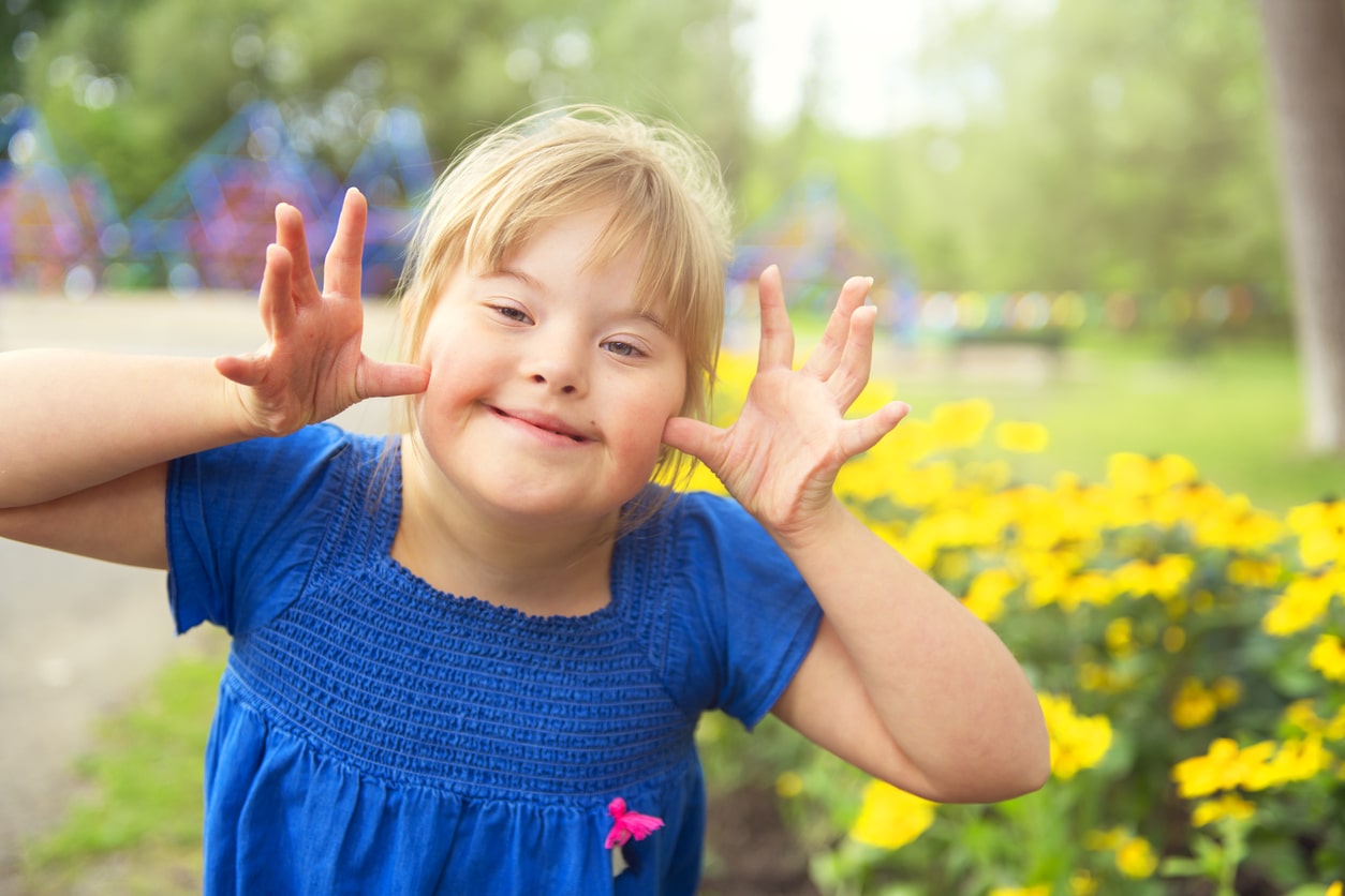 Soñar Con Un Niño Con Sindrome De Down - Cada Sueño