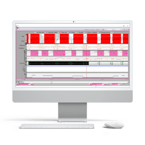 BTI APNiA Simplified Respiratory Polygraphy - Image 3