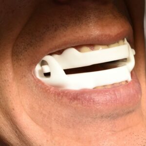 OrthoApnea Noa - Imagen 3